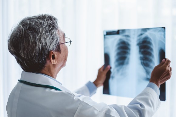 Doctor reviewing X-ray